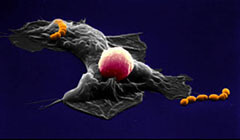 Human Macrophage, Lymphocyte and Streptococcus pyogenes